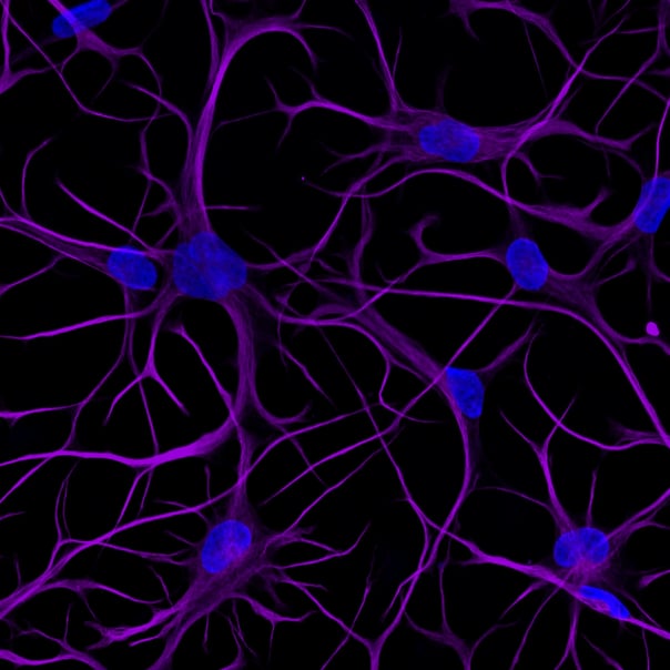 NRN1 as a therapeutic target for Alzheimer's disease