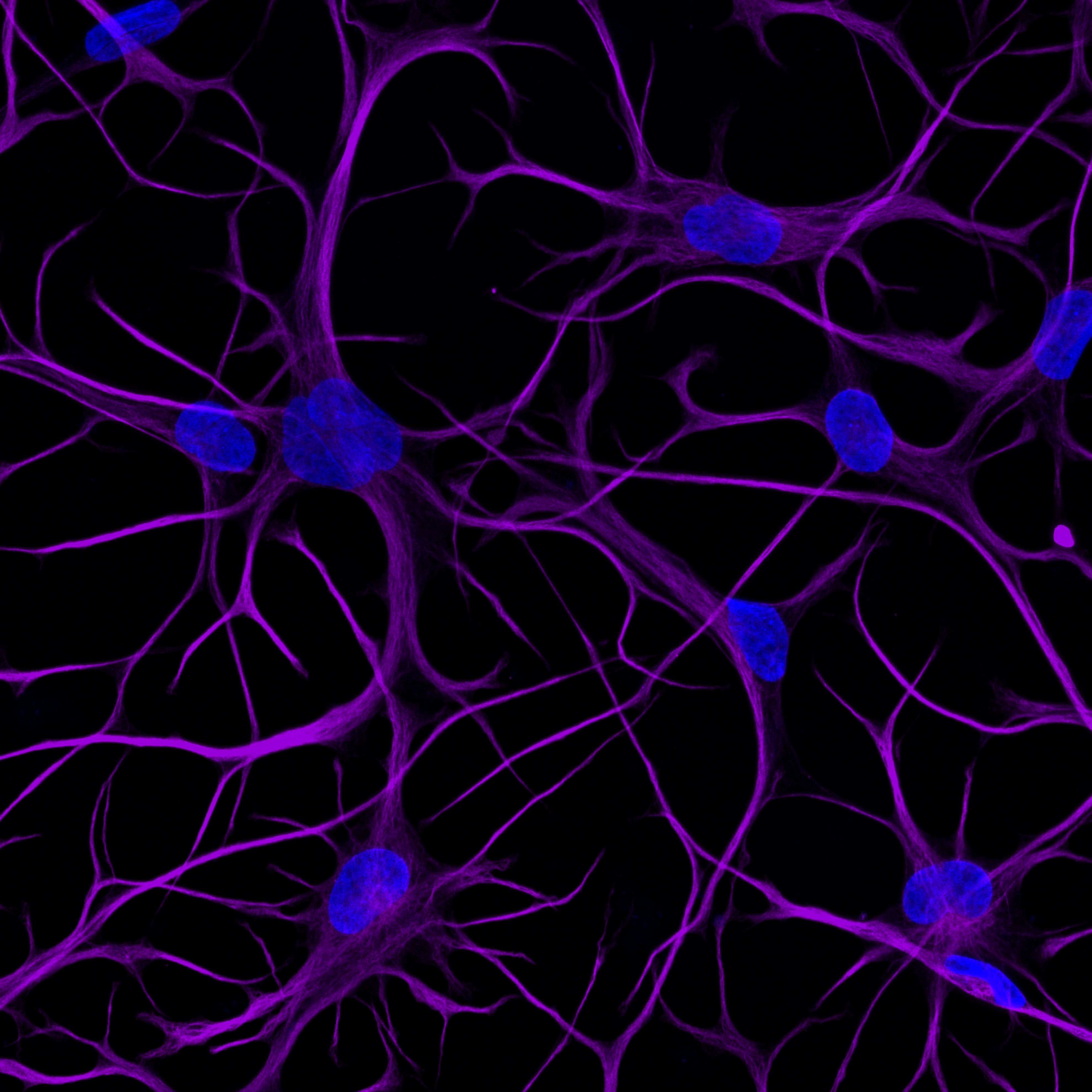 ioAstrocytes