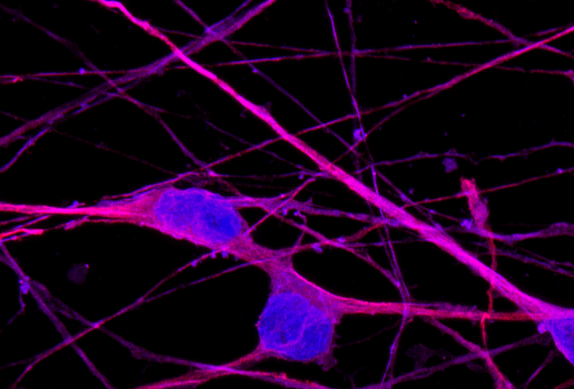 bit.bio_ioGlutamatergic Neurons_60xMAP2(red)Hoescht(blue)TUBB3(blue)_day4