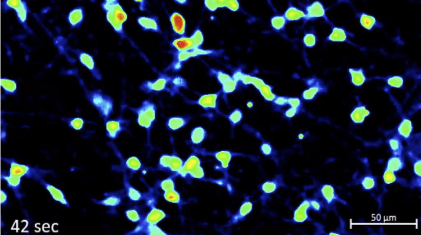 Video showing spontaneous activity of  human iPSC-derived GABAergic Neurons subjected to calcium imaging.