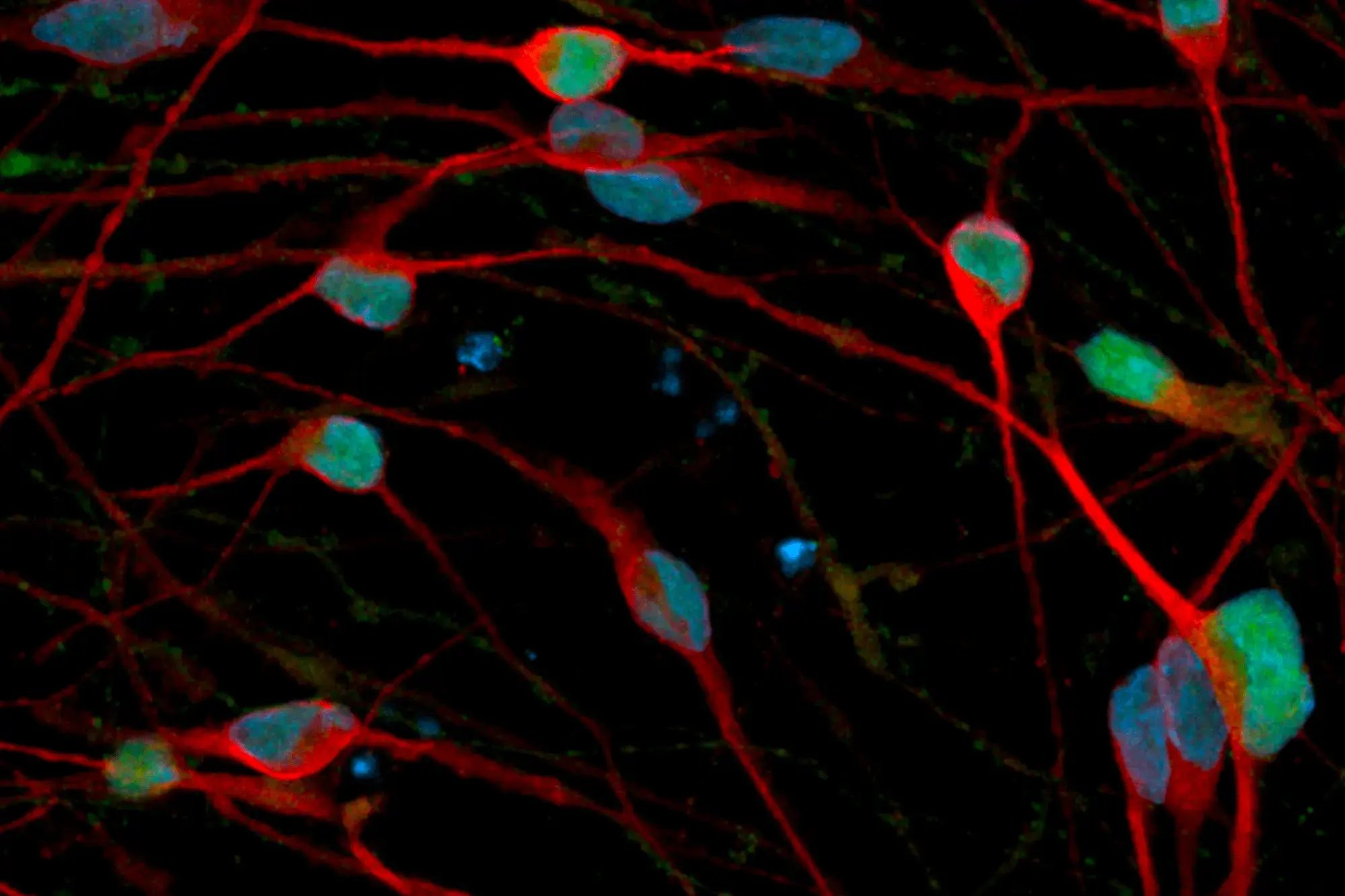 ioGABAergic Neurons