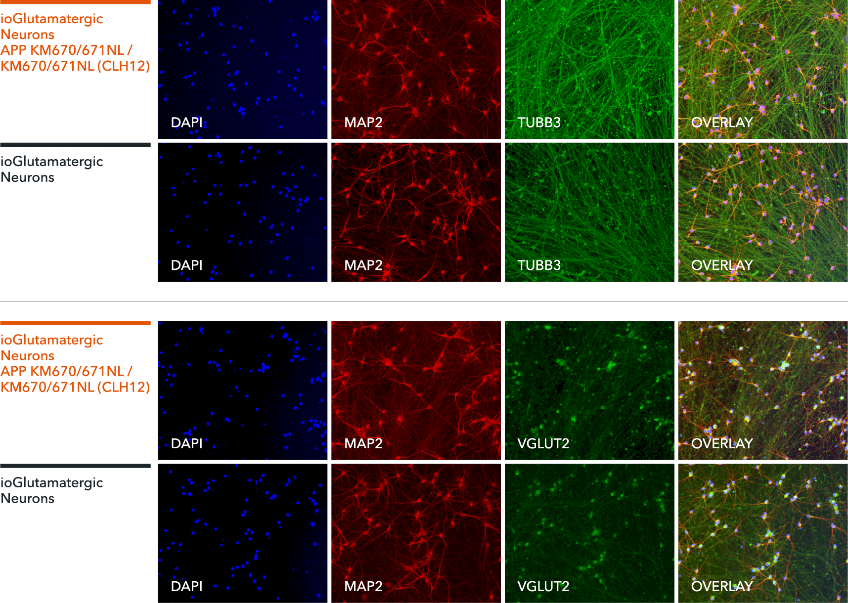 bit.bio Alzheimers disease model Swedish mutation ICC staining for glutamatergic neuron  specific markers VGLUT2 MAP2 TUBB3