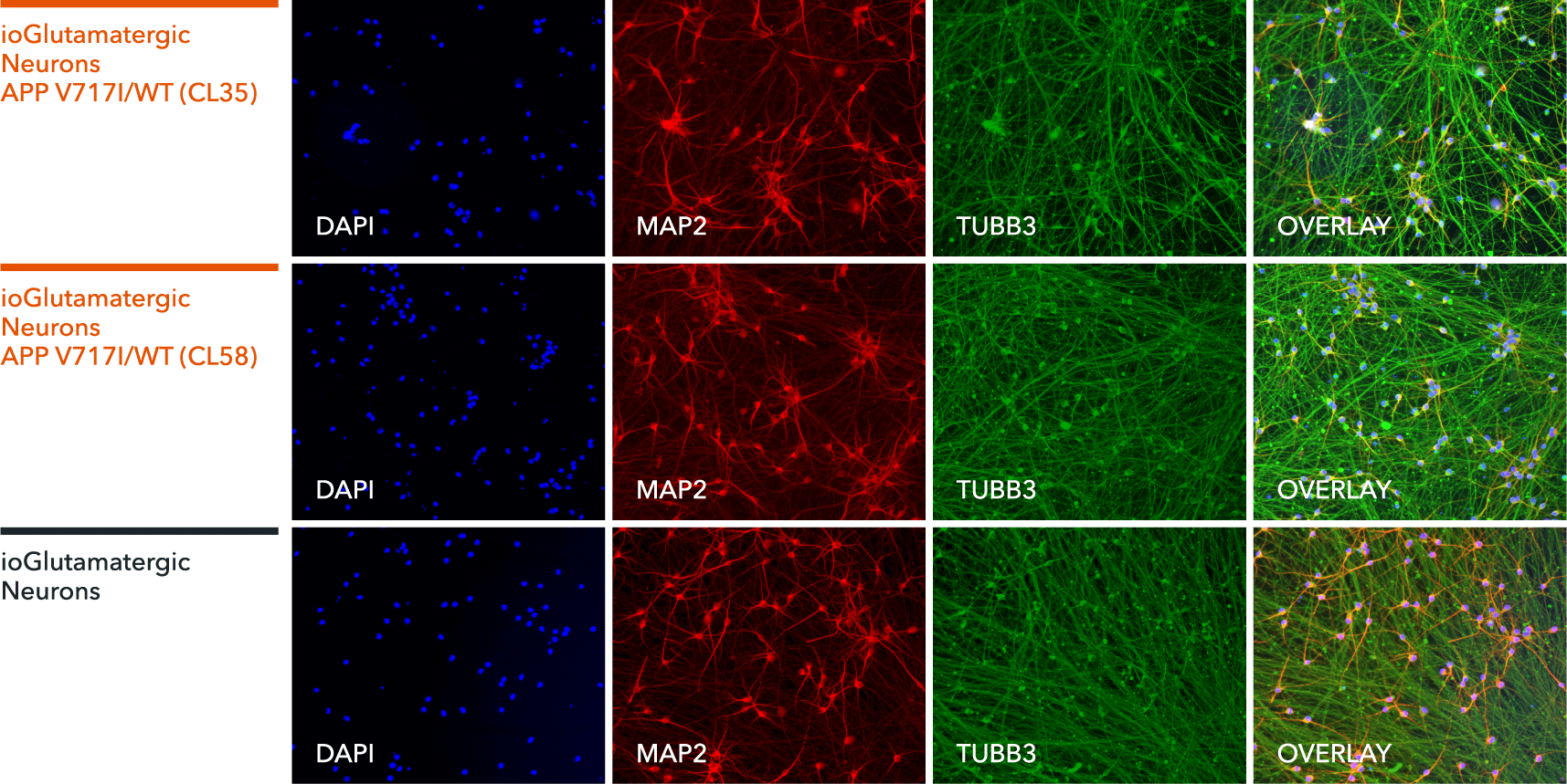 io1067-io1068-ioGlutamatergic Neurons APP-V717I-het-ICC-MAP2-TUBB3