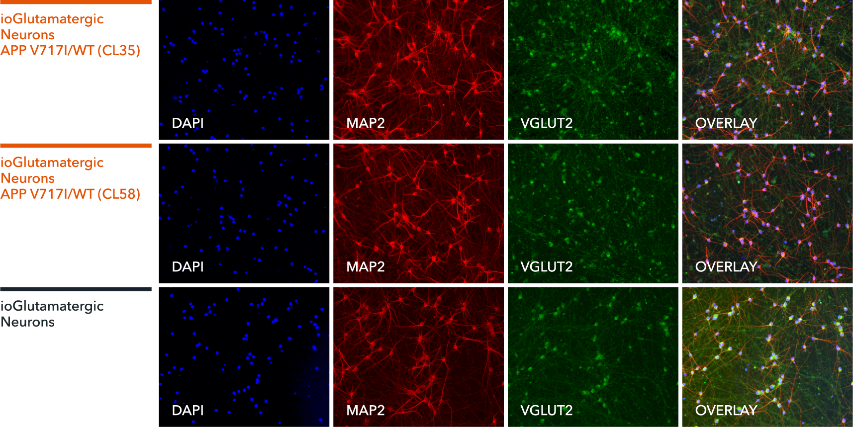 io1067-io1068-ioGlutamatergic Neurons APP-V717I-het-ICC-MAP2-VGLUT2