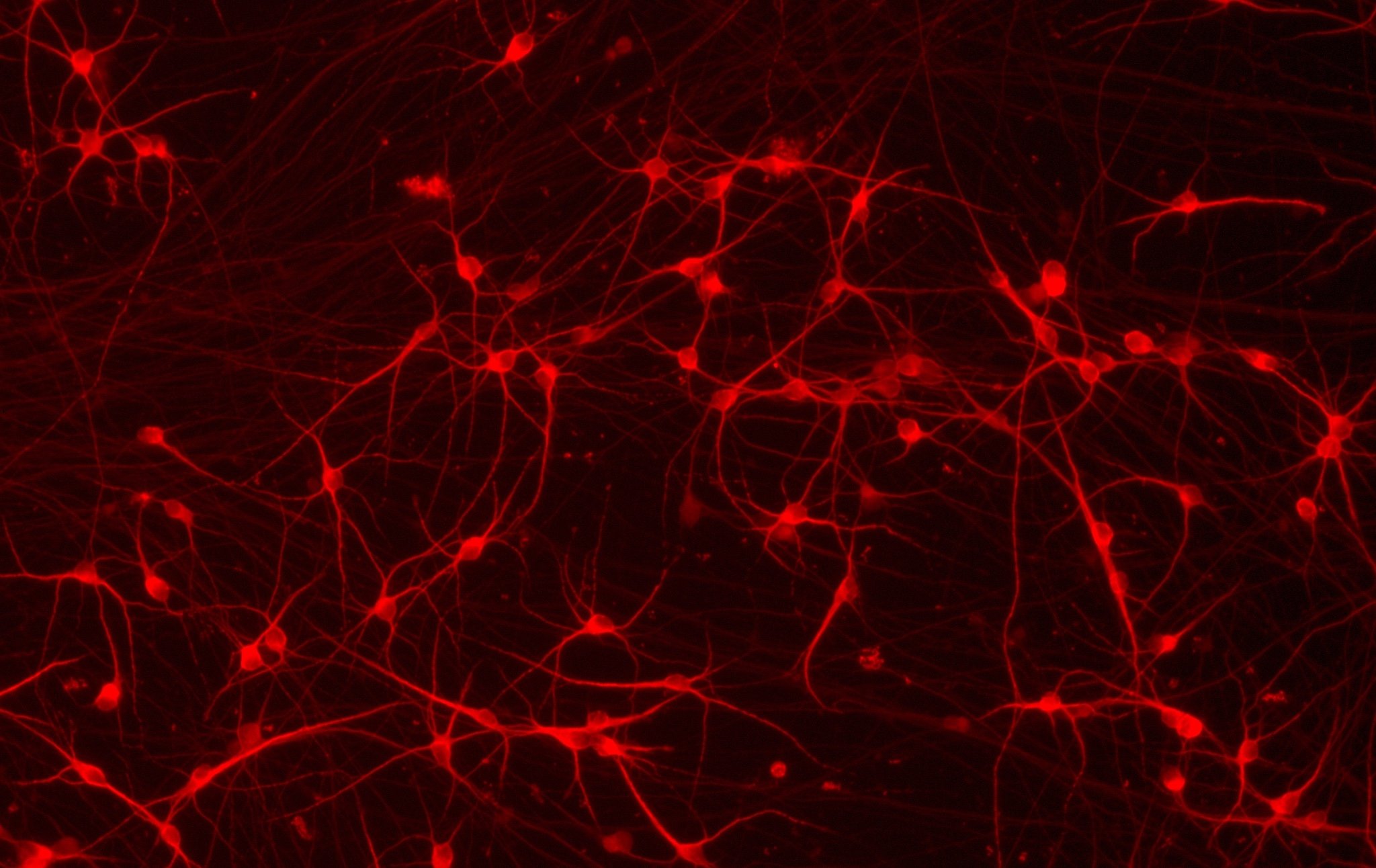 CRISPR-Ready ioGlutamatergic Neurons™