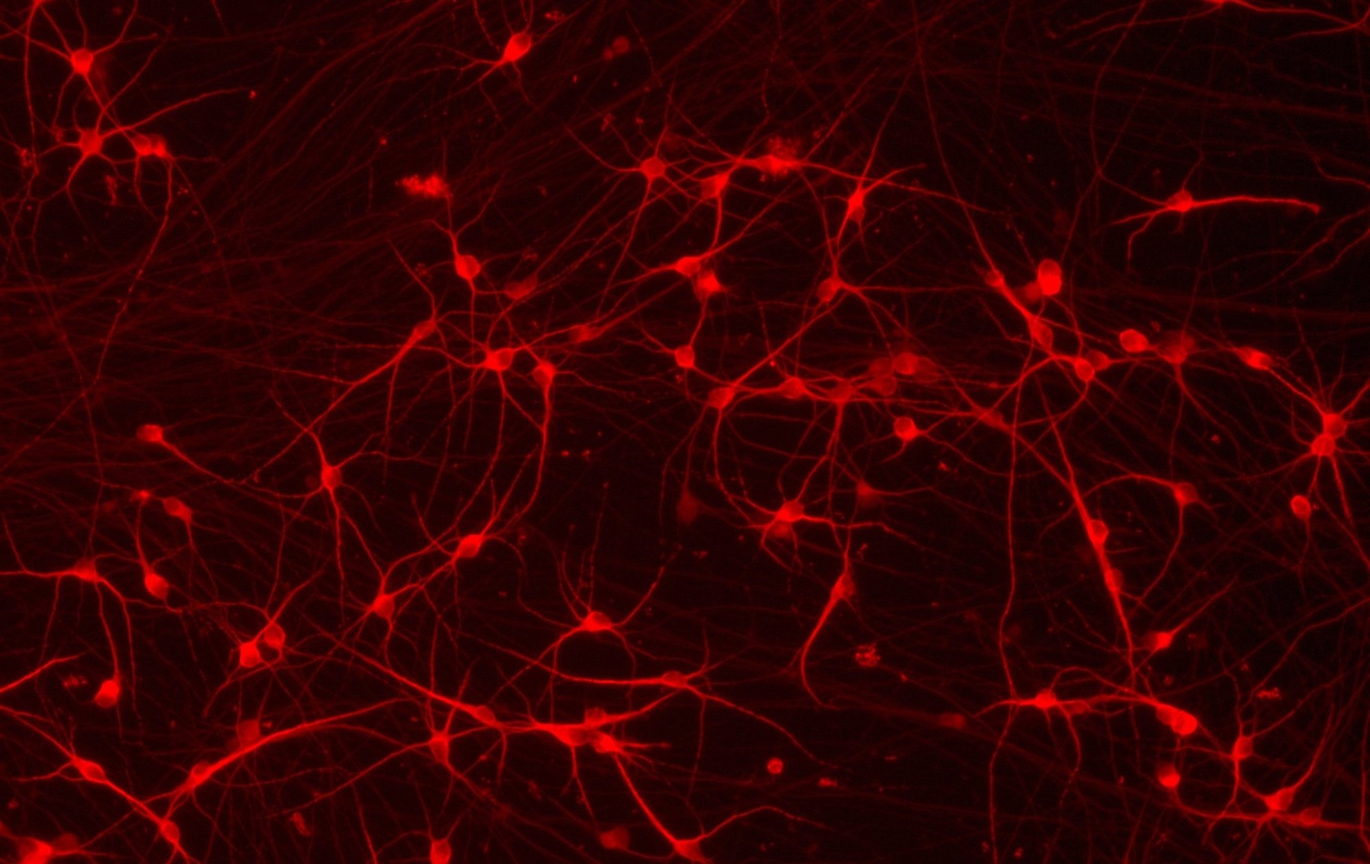ioGlutamatergic-Neurons-CRISPR-Ready-Hero-Image copy