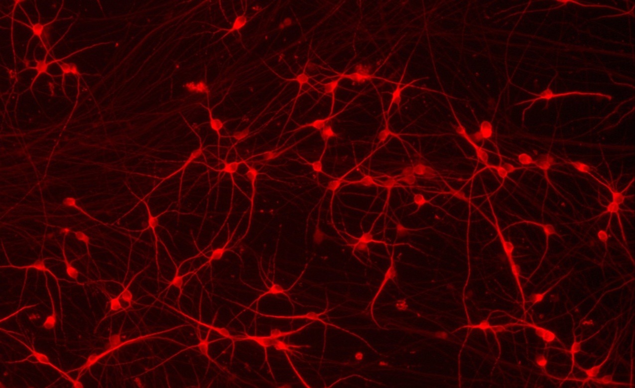 ioGlutamatergic-Neurons-CRISPR-Ready-Hero-Image-1-1