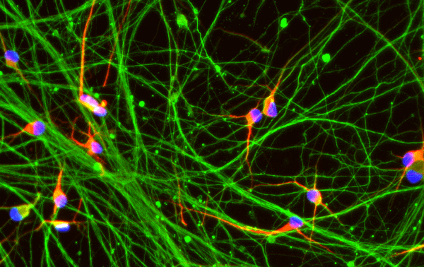 Developing next-generation in vitro phenotypic assays for Huntington’s disease by combining a precision reprogrammed hiPSC-derived disease model with high-density microelectrode arrays