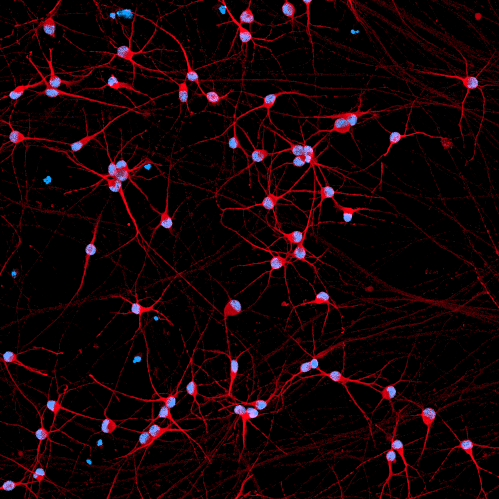 ioGlutamatergic Neurons SNCA A53T homozygous stained for MAP2 and DAPI