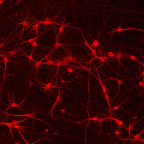 mRNA transfection of ioGlutamatergic Neurons