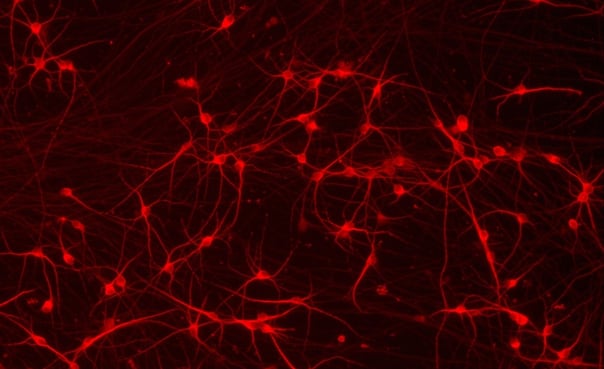 MEA workshop: Tips and tricks for iPSC-derived neurons