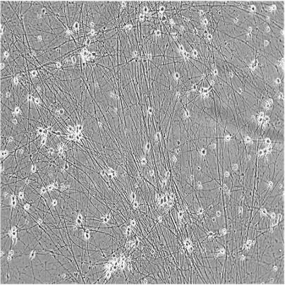 WT isogenic control brightfield day 11