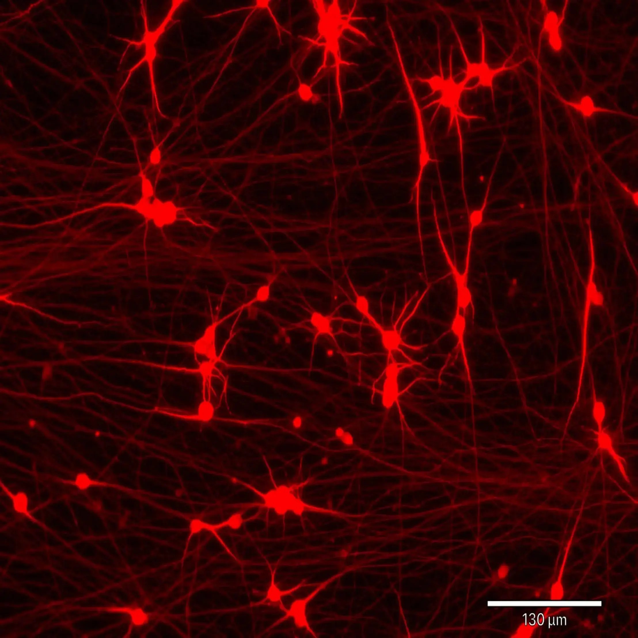 bit.bio ioGlutamatergic Neurons - Day 11 - MAP2 (1)