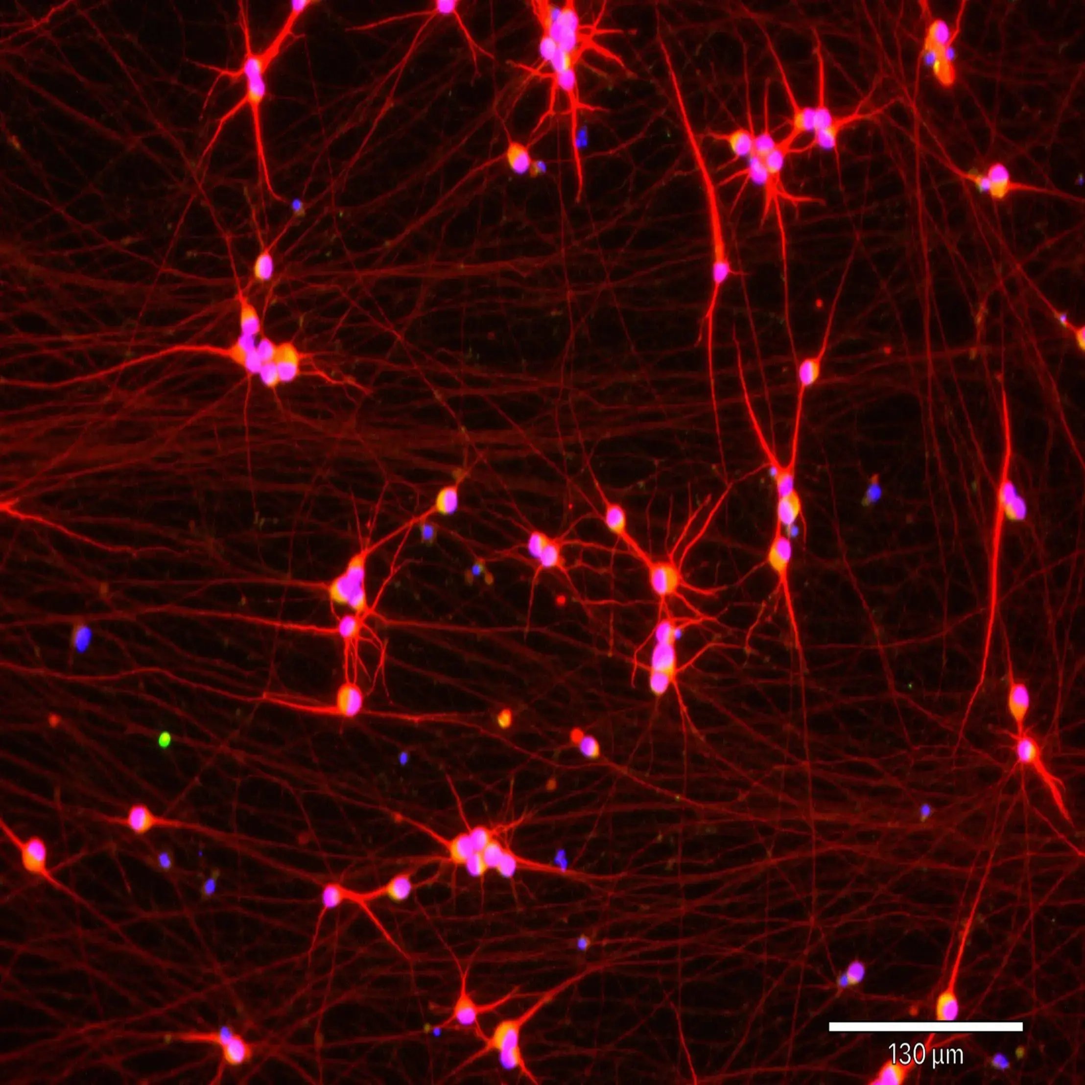bit.bio ioGlutamatergic Neurons - Day 11 - MERGE VGLUT2(g) MAP2(r) DAPI(b) (1)