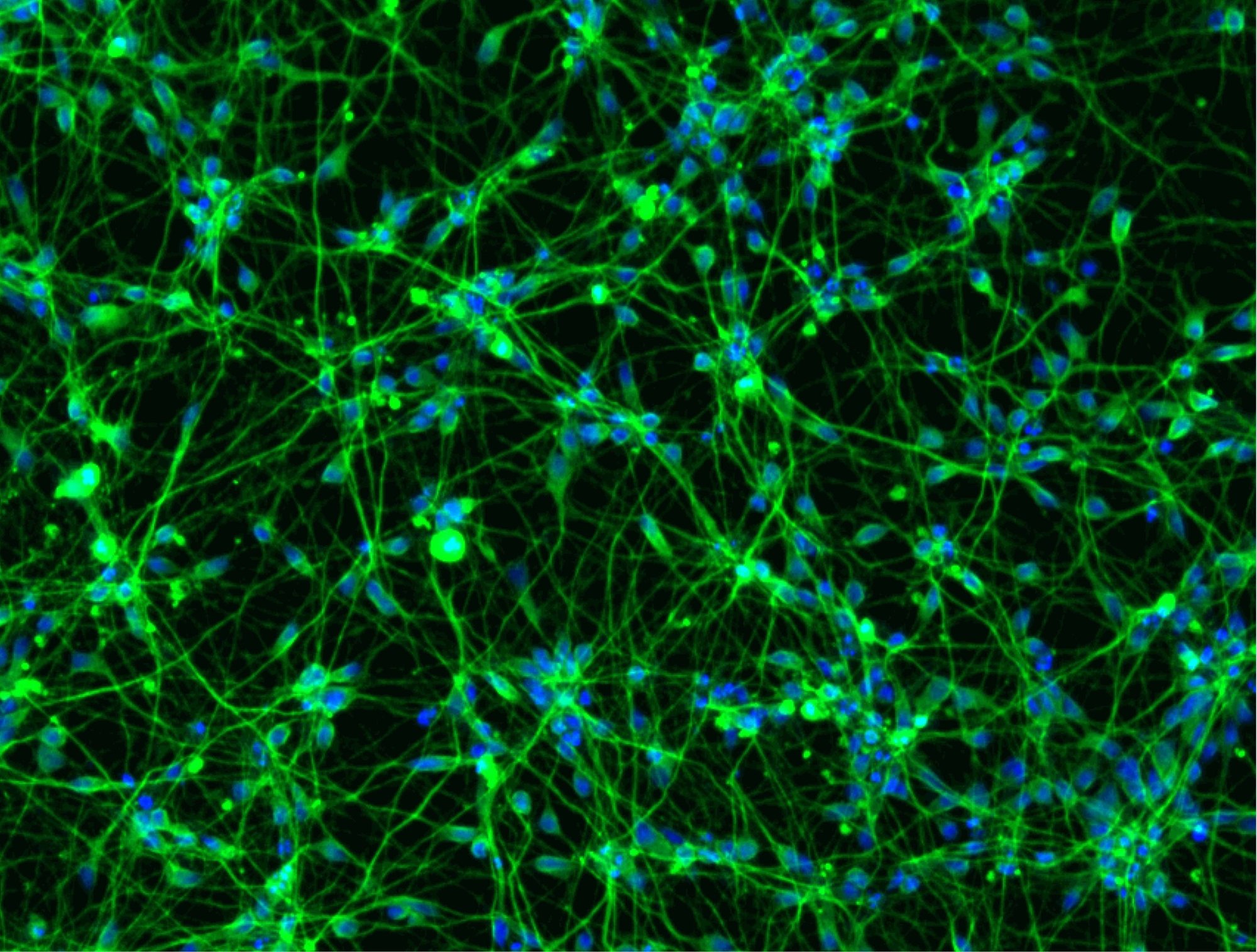 Immunocytochemistry staining of human iPSC-derived glutamatergic neurons to identify, characterise, and validate in vitro.