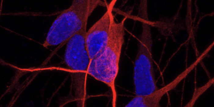 bit.bio_ioGlutamatergic Neurons_MAP2_Hoescht_x60_Social_crop