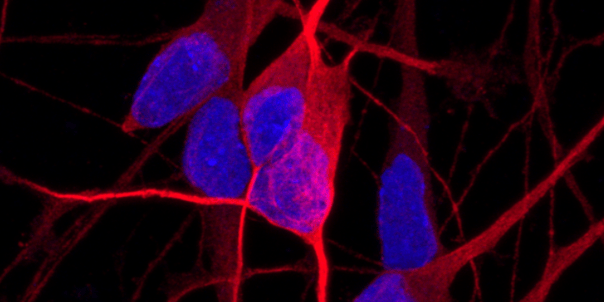 Alzheimer’s disease models in iPSC-derived glutamatergic neurons show increased secretion of pathogenic amyloid beta peptides