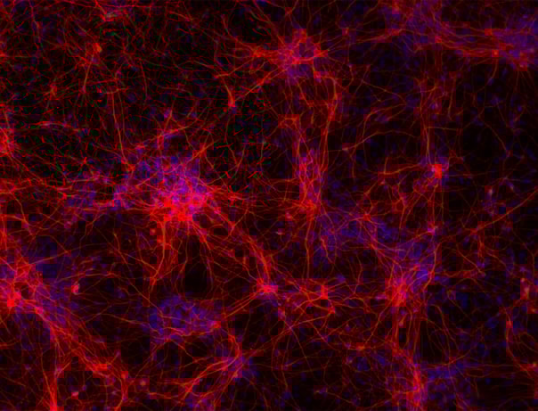 Schizophrenia risk gene ZNF804A controls ribosome localization and synaptogenesis in developing human neurons