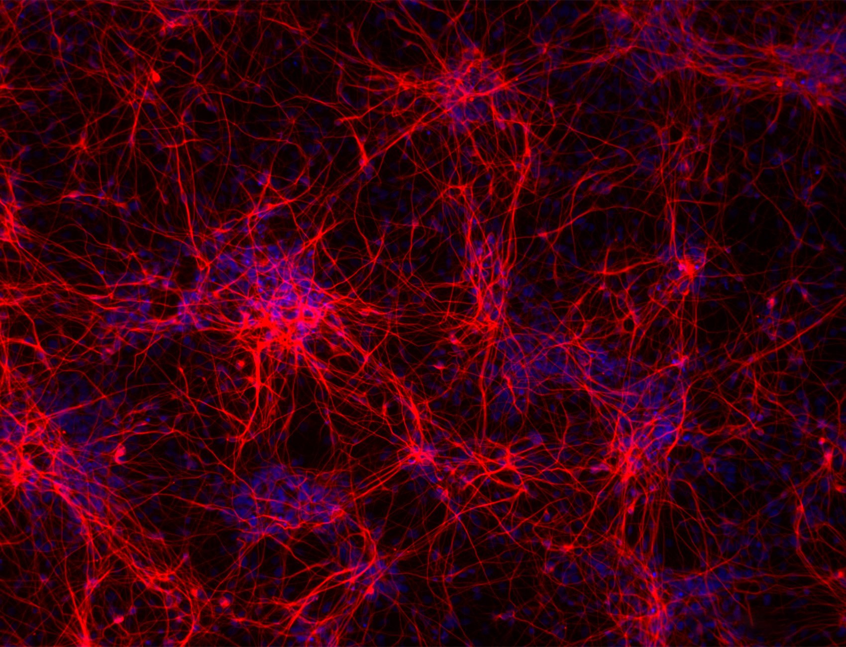 High Content Analysis of 2D and 3D cellular models for target and phenotypic drug discovery