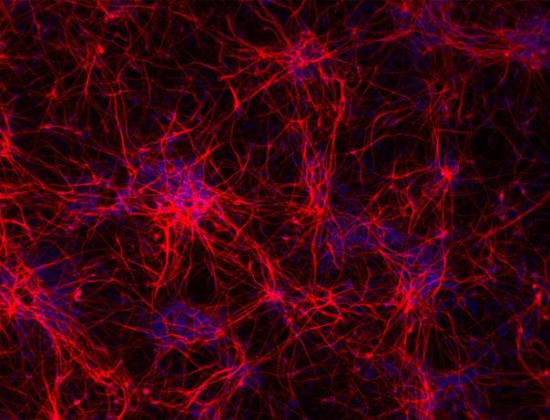 3D bioprinting of iPSC neuron-astrocyte coculture