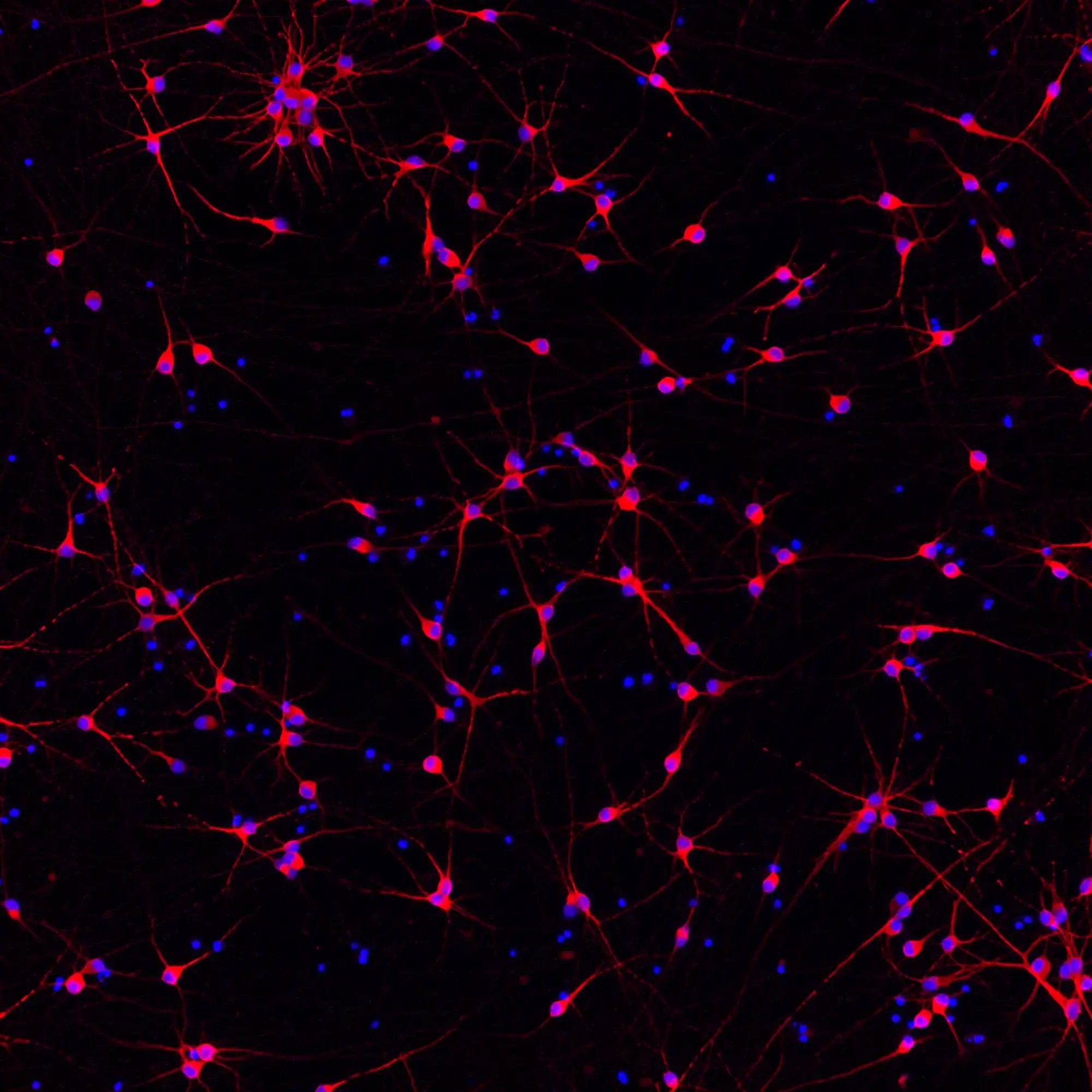 io1114-glutamatergic-neurons-apoe-4-4-dapi-map2