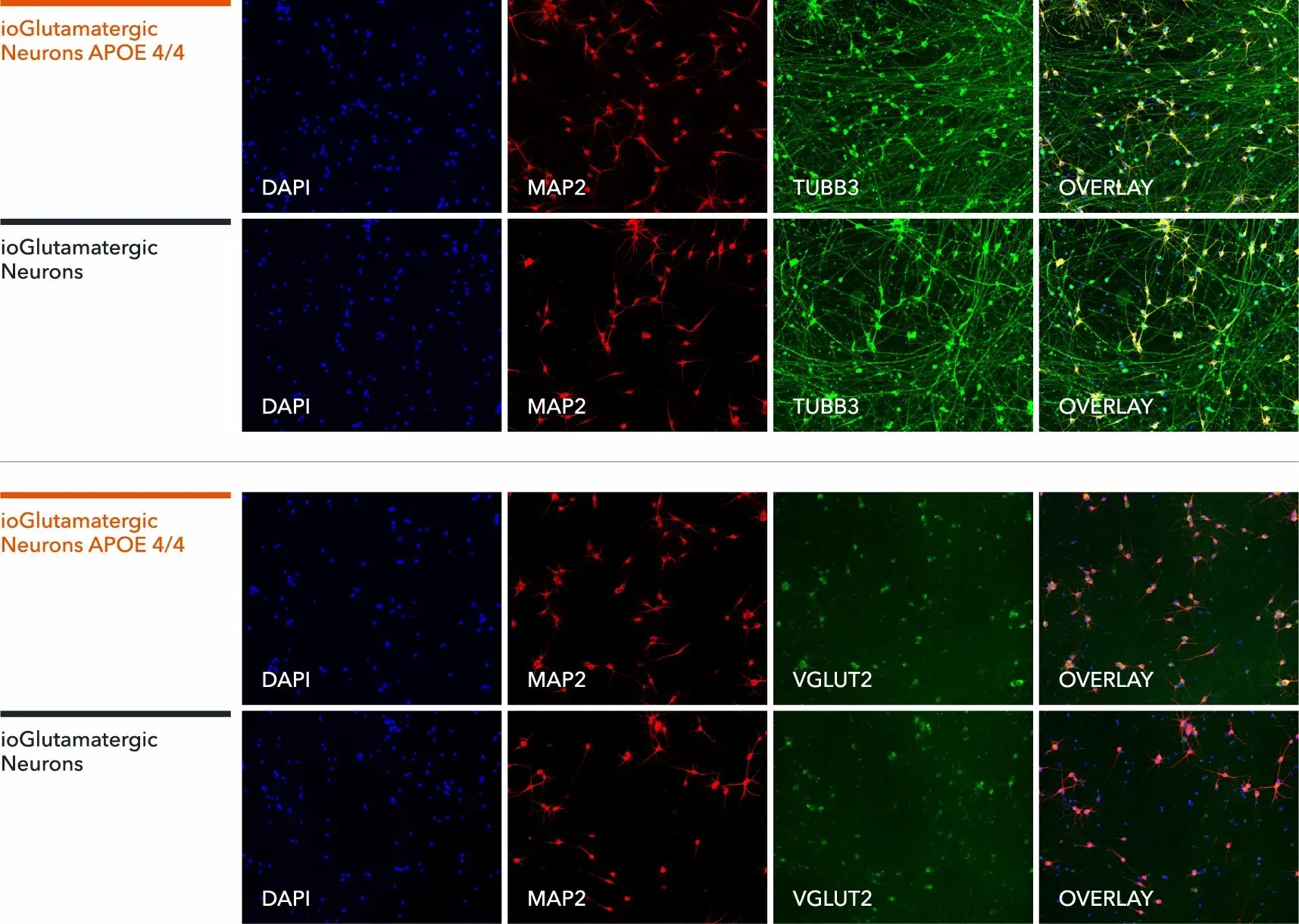 io1114-glutamatergic-neurons-apoe-4-4-map2-tubb3-vglut2
