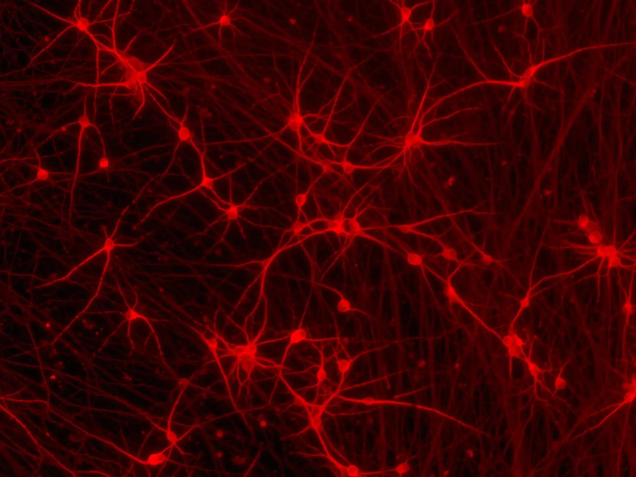 ioGlutamatergic Neurons GBA null/R159W