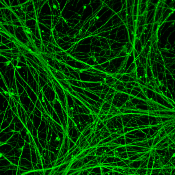 Physiologically relevant media unmasks severe mitochondrial dysfunction in a precision reprogrammed iPSC-derived model of Huntington's disease