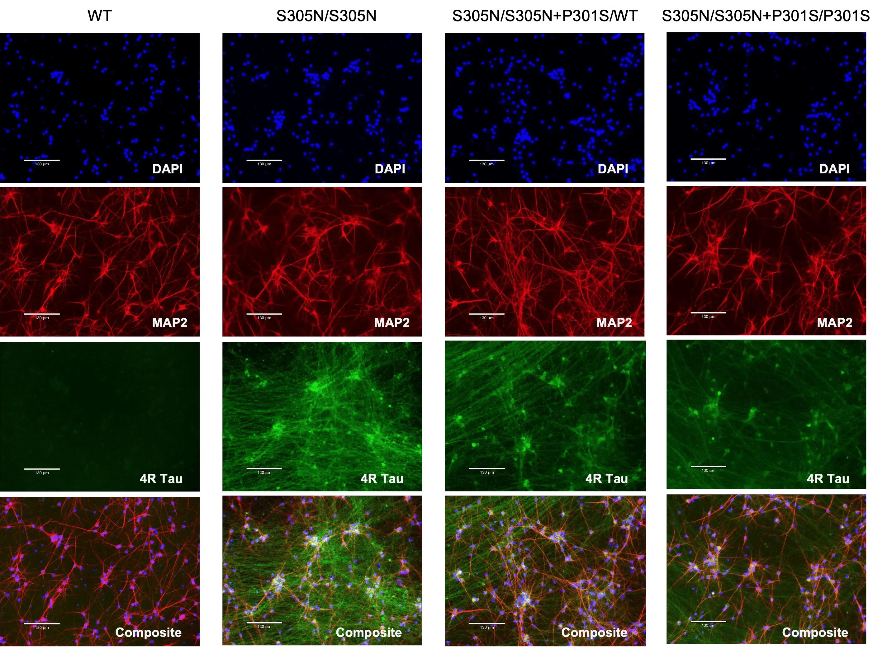 bit.bio-glutamatergic-neurons-mapt-s305n-p301s-protein-expression-4r-tau