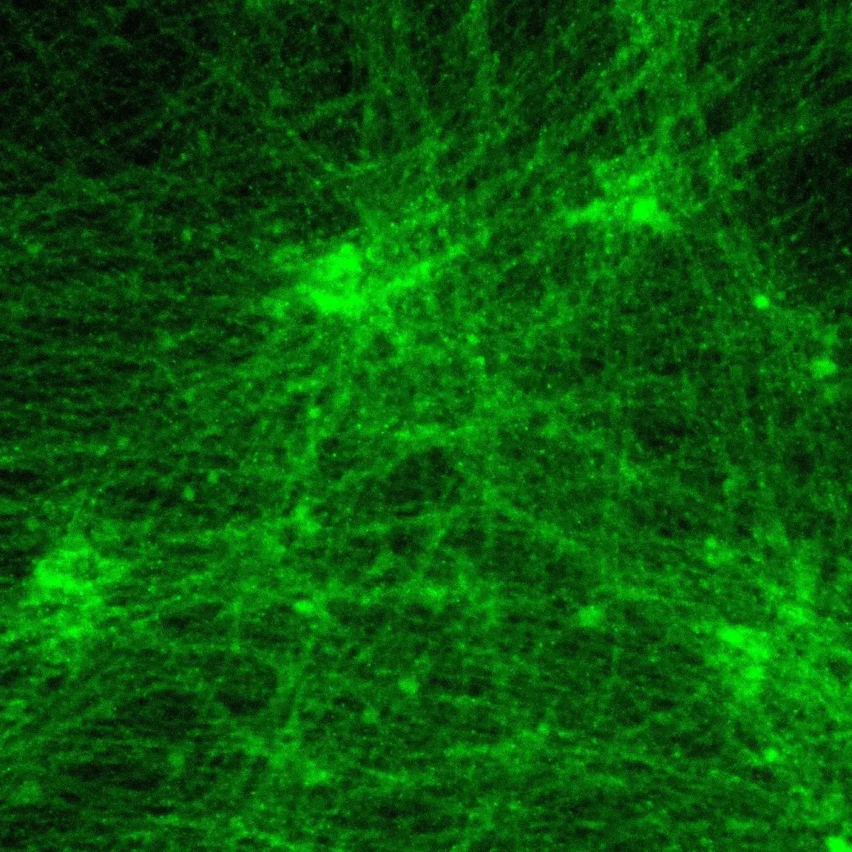 ioGlutamatergic Neurons MAPT S305N/S305N