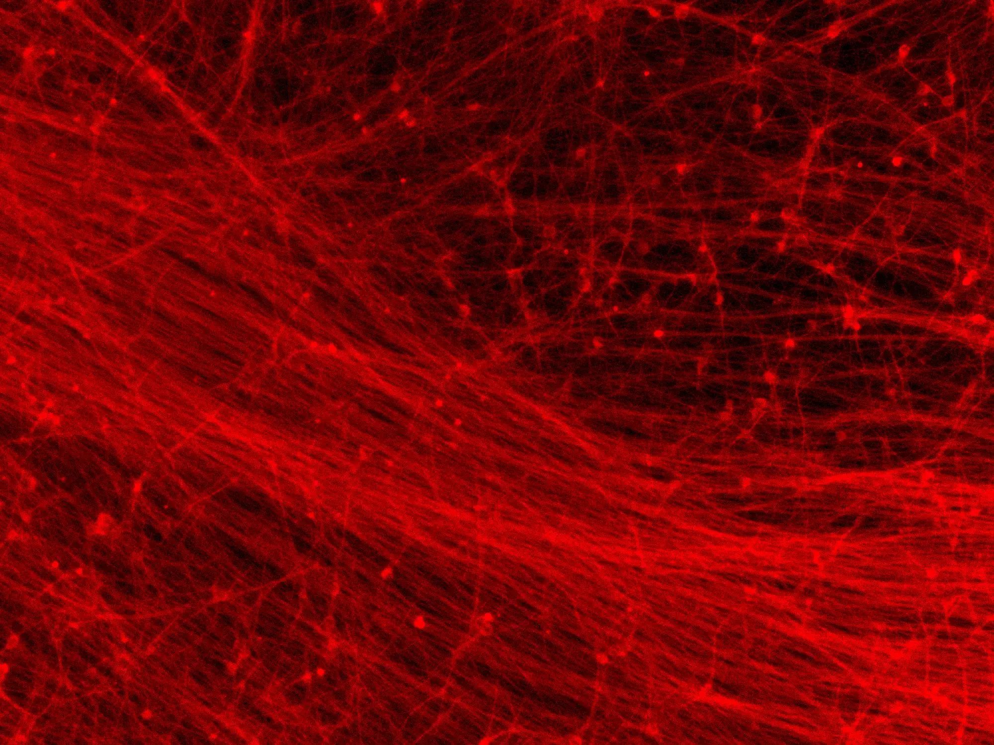 ioGlutamatergic Neurons MAPT S305N/S305N