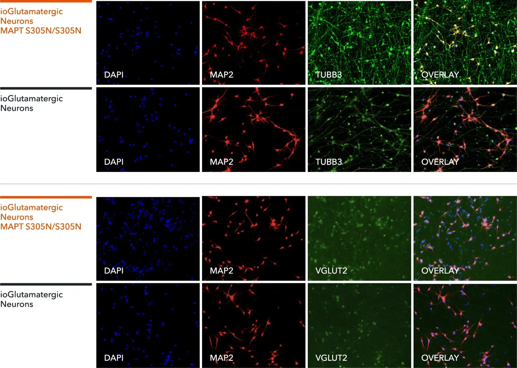 bitbio-io1115-glutamatergic-neurons-MAPT-S305N-hom-ICC-MAP2-TUBB3