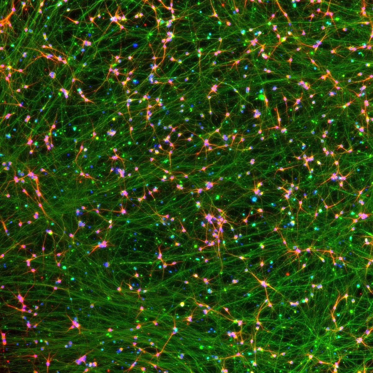 bit.bio-io1116-glutamatergic-neurons-mapt-s305n-map2-tubb3-expression