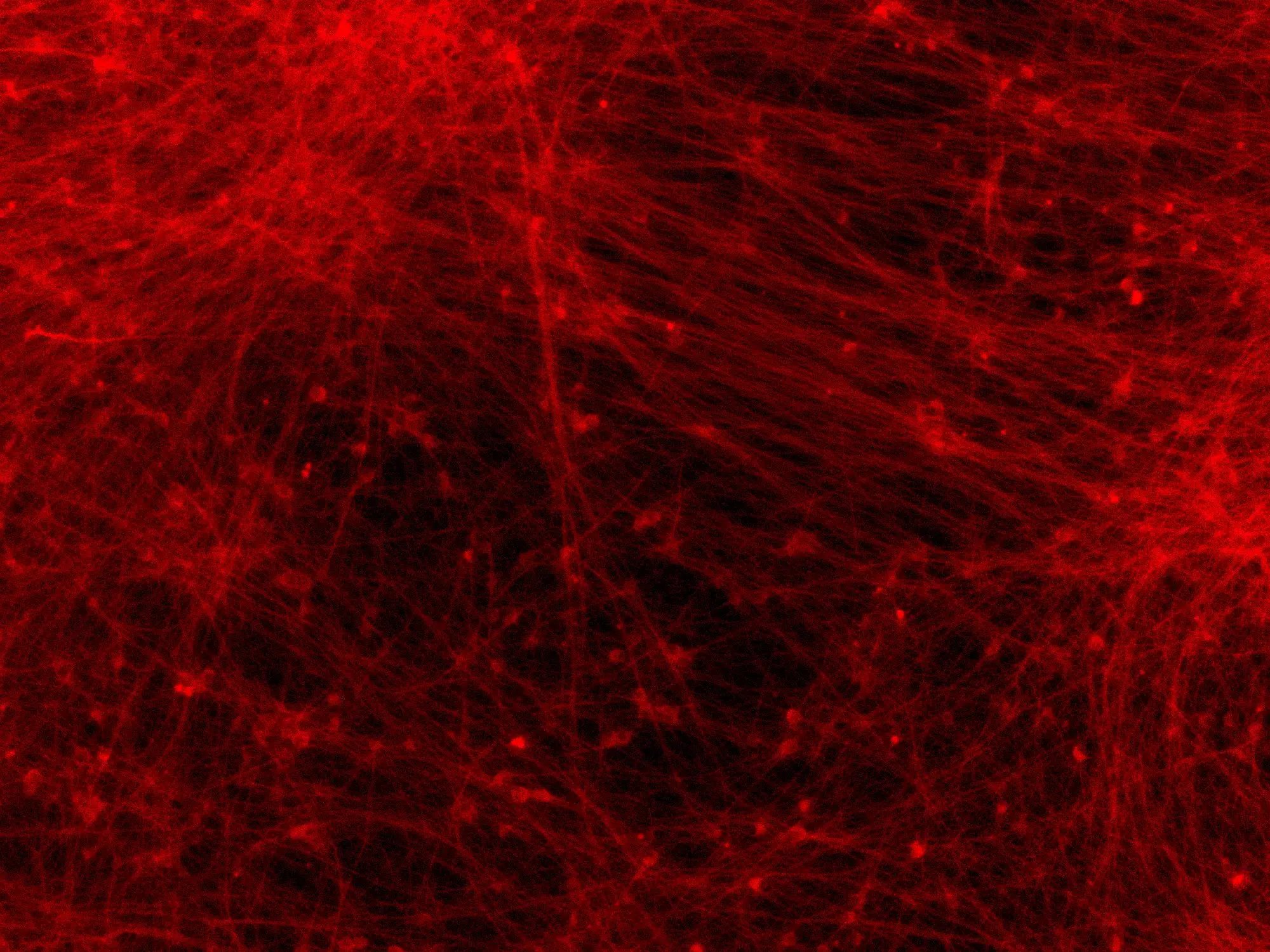 ioGlutamatergic Neurons MAPT S305N/S305N;P301S