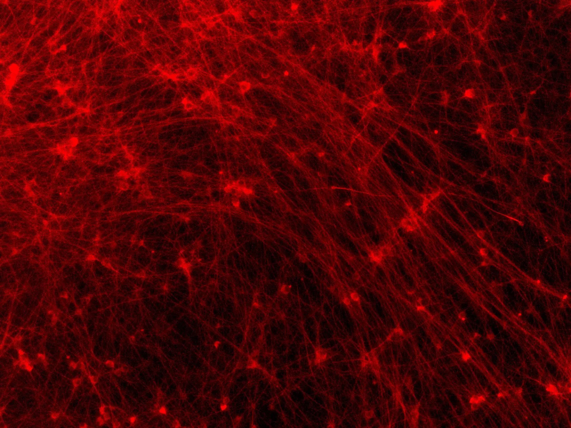 ioGlutamatergic Neurons MAPT S305N;P301S/S305N;P301S