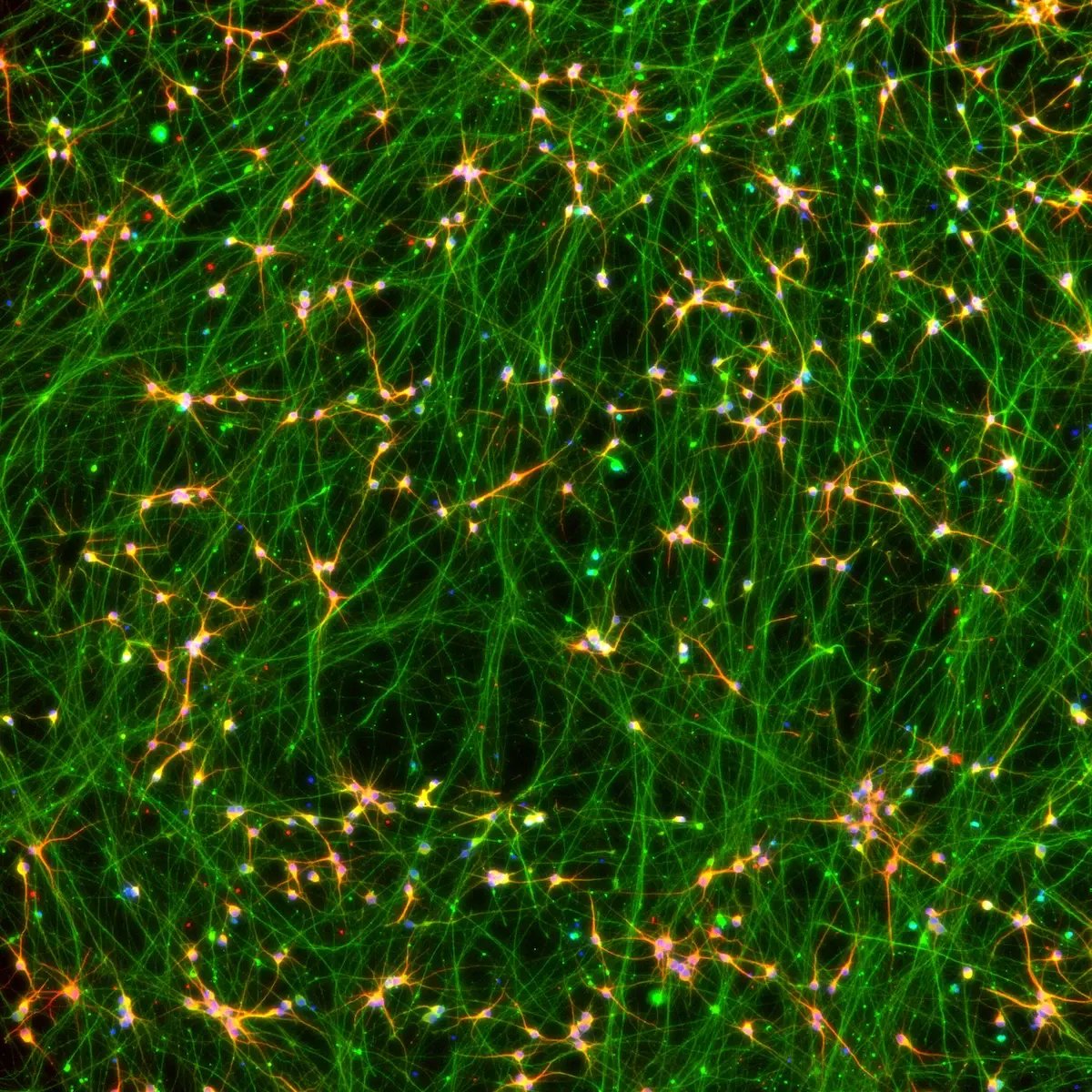 bit.bio-io1117-glutamatergic-neurons-mapt-s305n-p301s-hom-map2-tubb3-expression