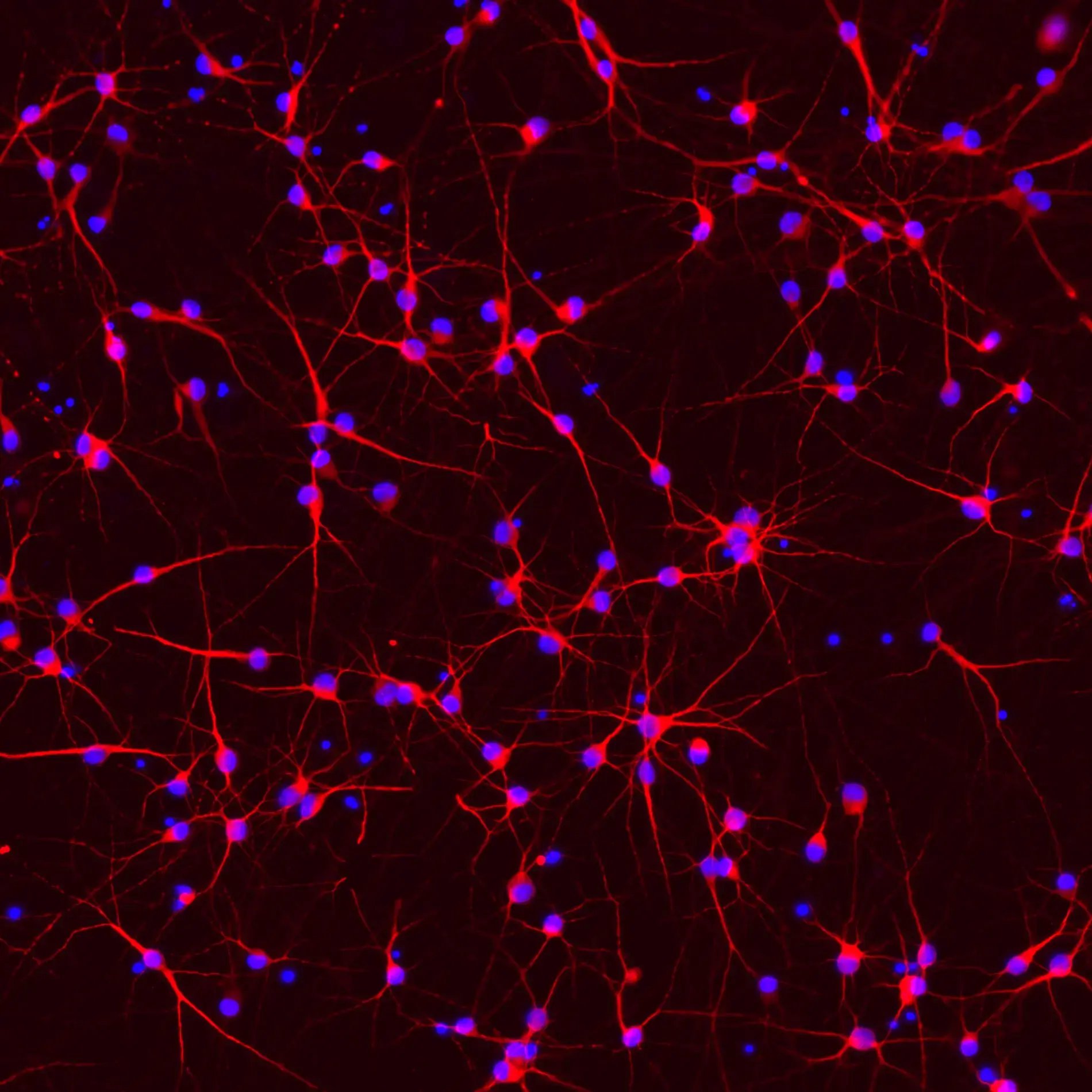 ioGlutamatergic Neurons PINK1 Q456X/WT