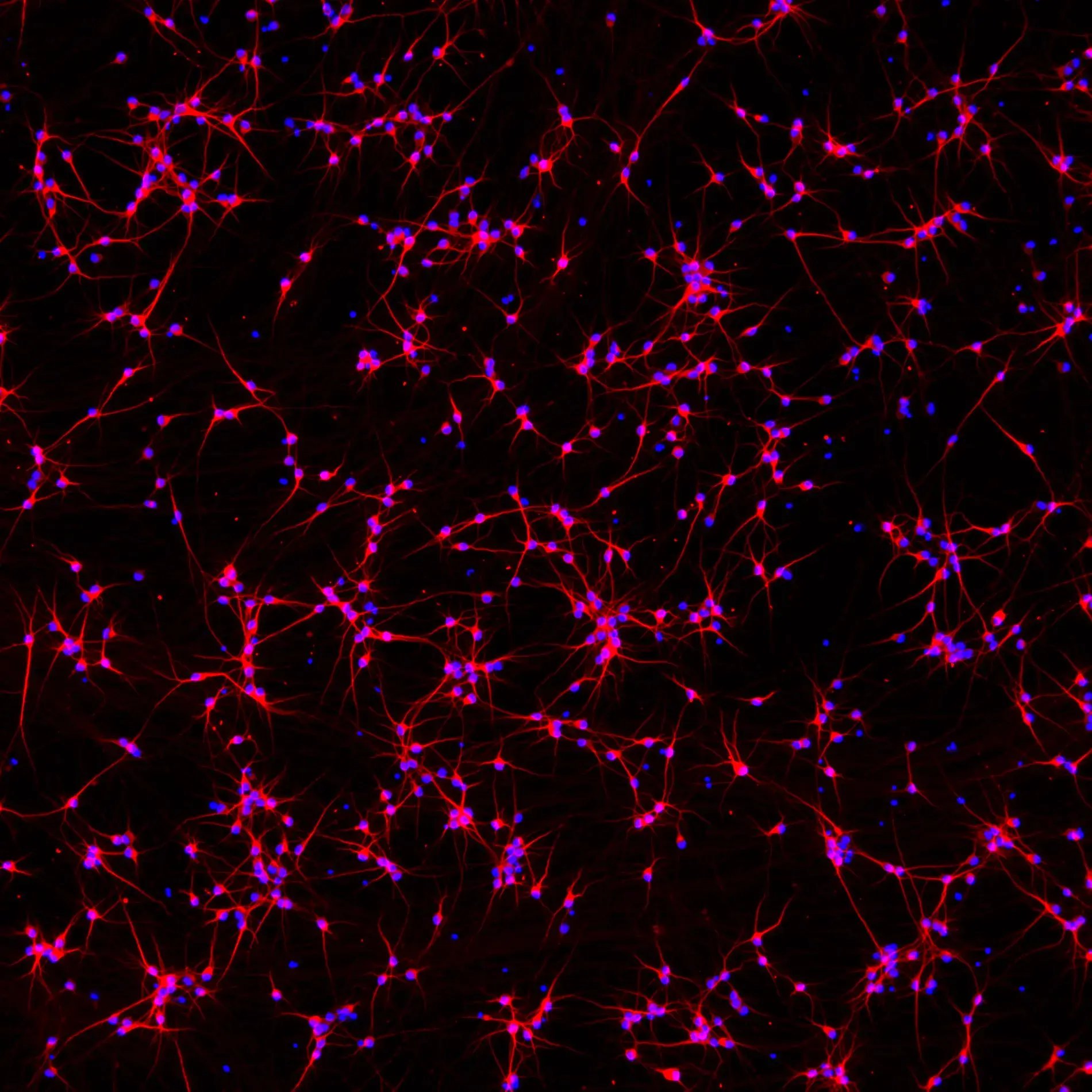 ioGlutamatergic Neurons SNCA A53T/WT