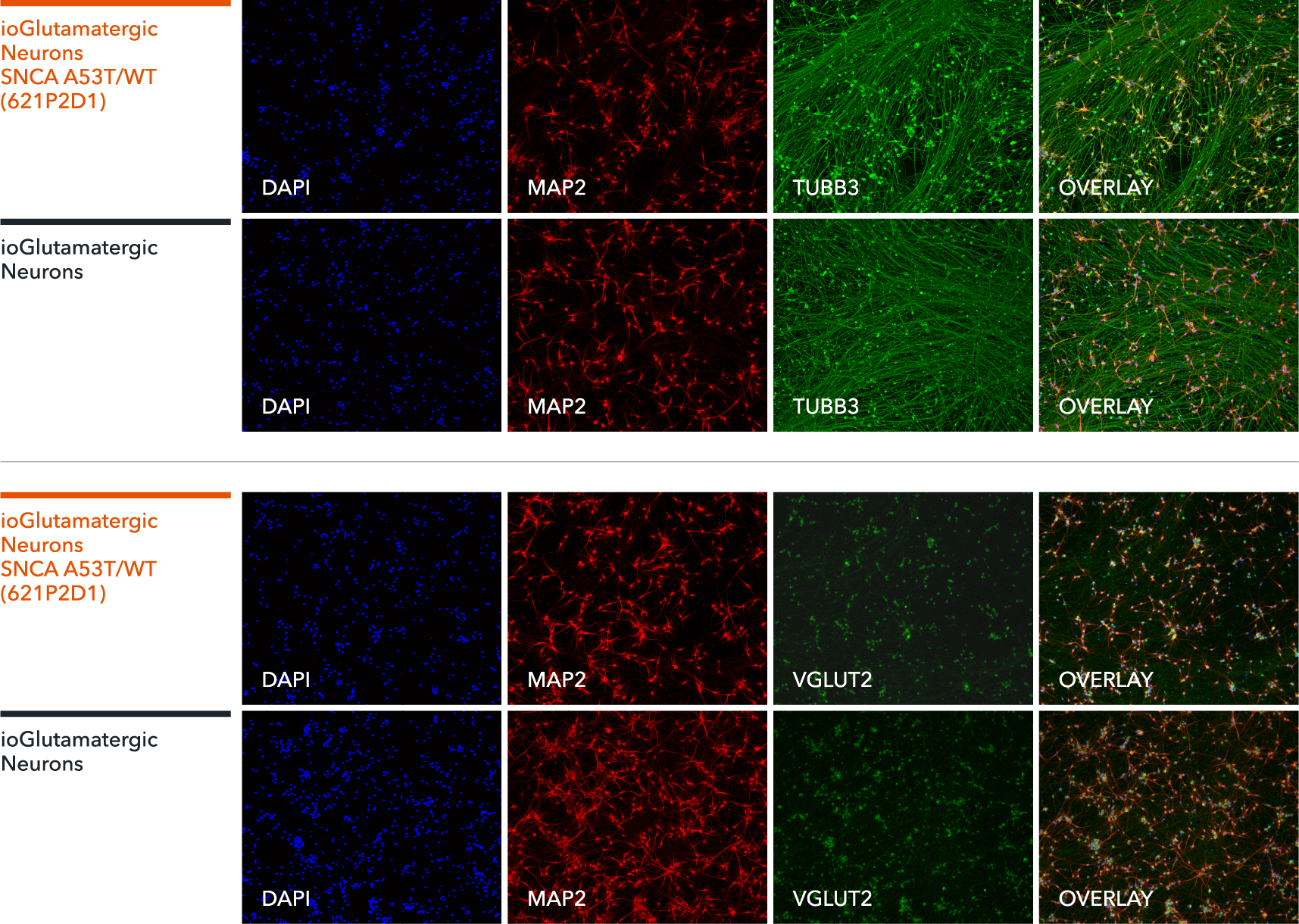 Glutamatergic Neurons SNCA A53T/WT express neuron-specific markers ICC staining