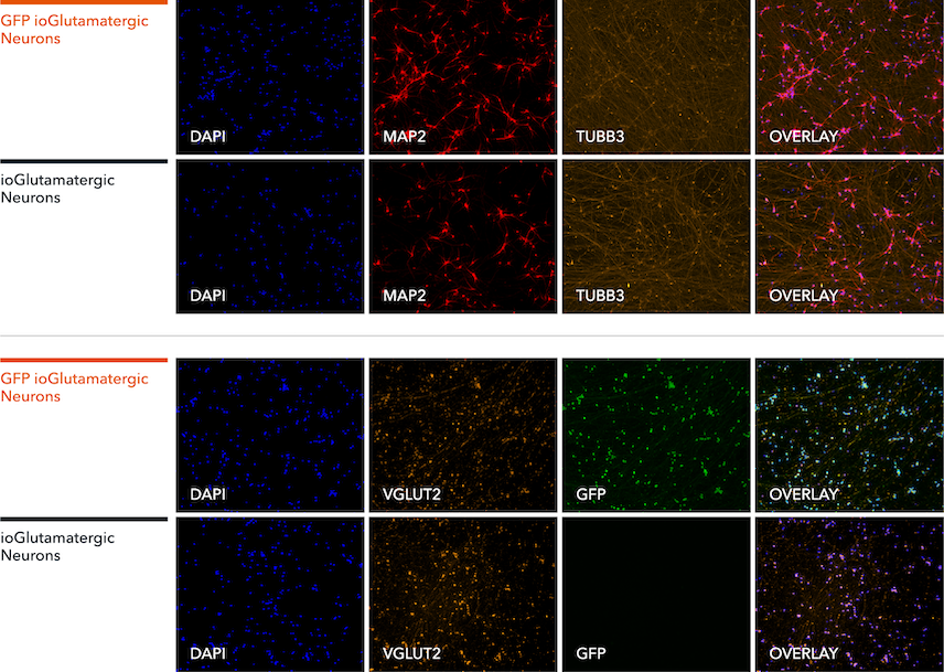 Neuronal marker protein expression in GFP glutamatergic neurons