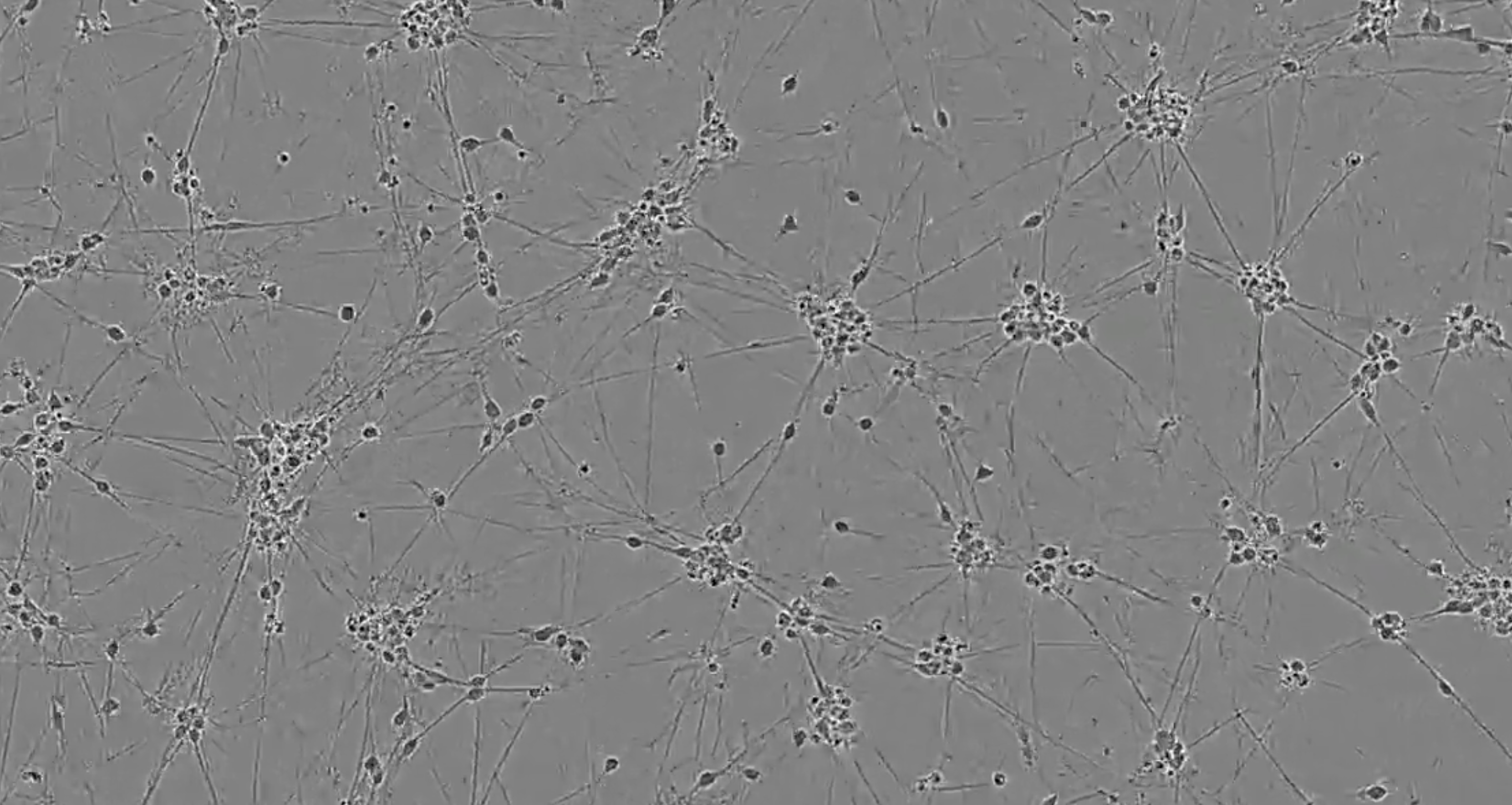 Time-lapse video capturing the rapid and homogeneous neuronal phenotype acquisition in cryopreserved neurons