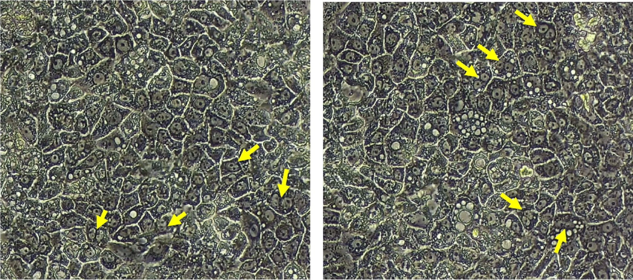 bit.bio_ioHepatocytes_morphology_Day9