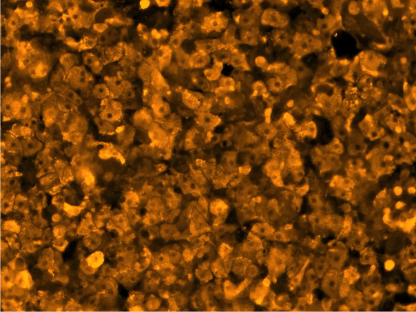 ioHepatocytes