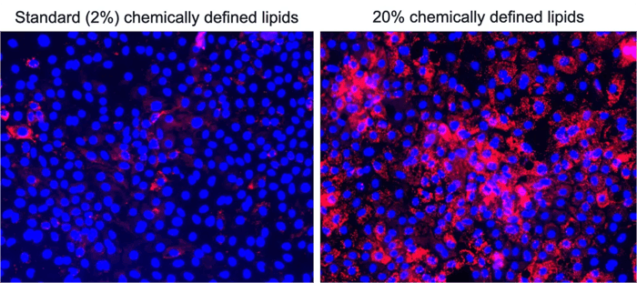 ioHepatocytes-lipid-uptake-accumulation
