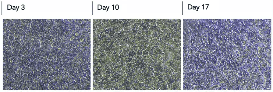 ioHepatocytes_morphology_day3-day10-day17