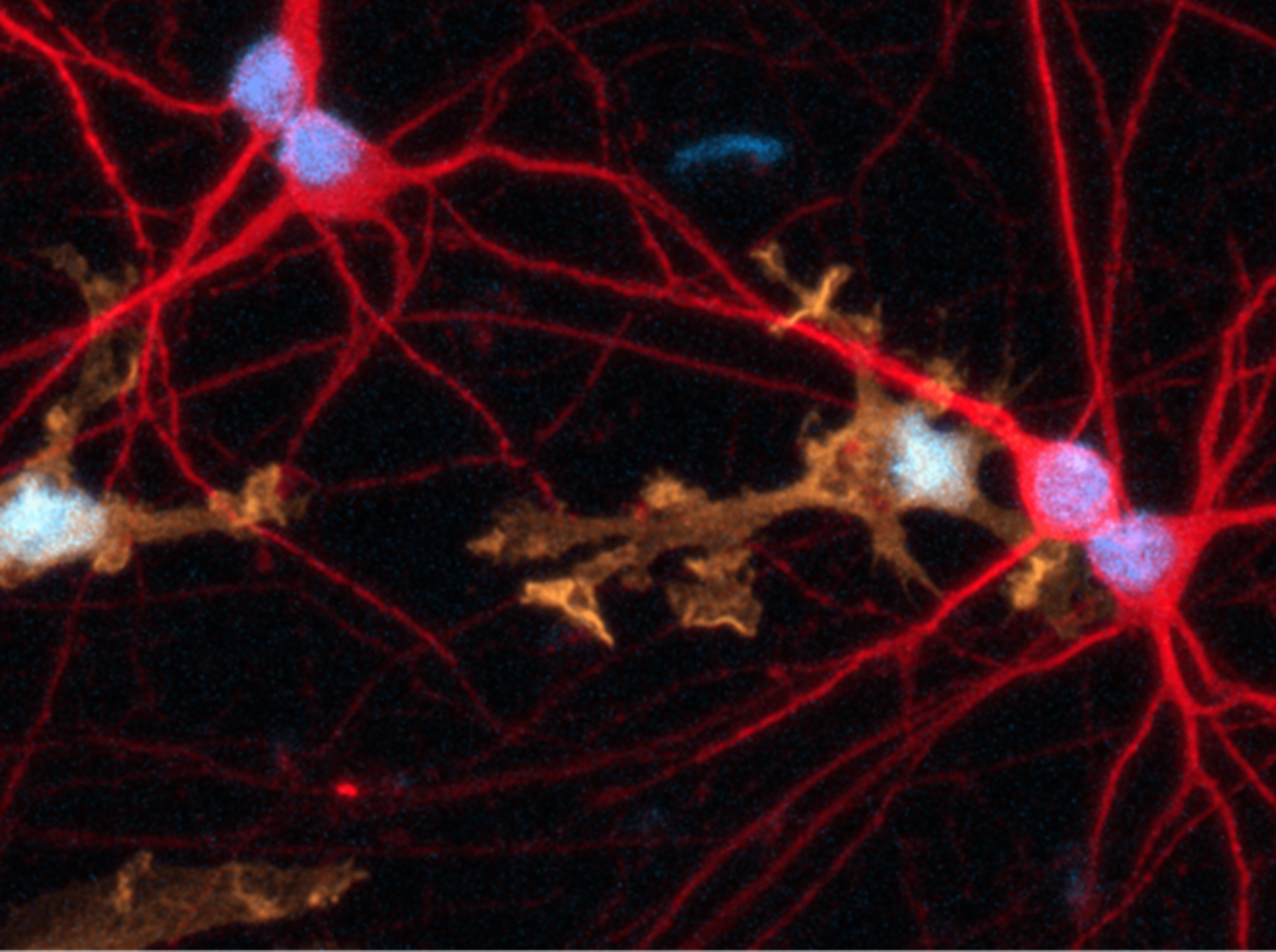 5C_ioMicrogliaConfocal image-1316x982