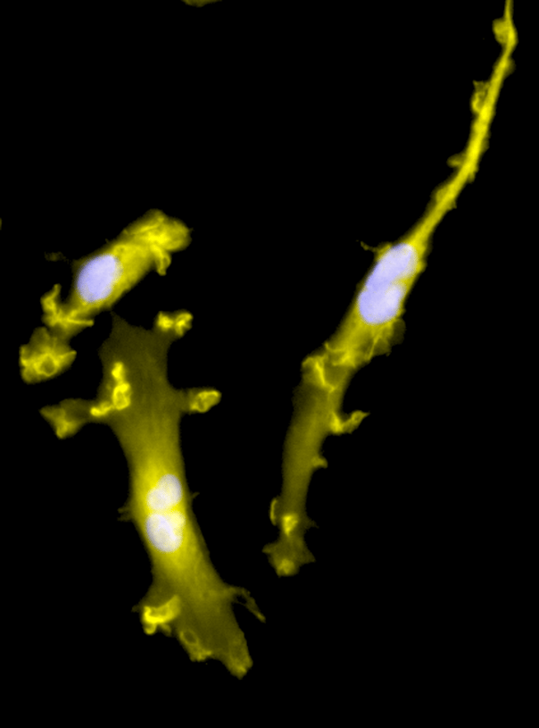 Circadian clocks in human cerebral organoids
