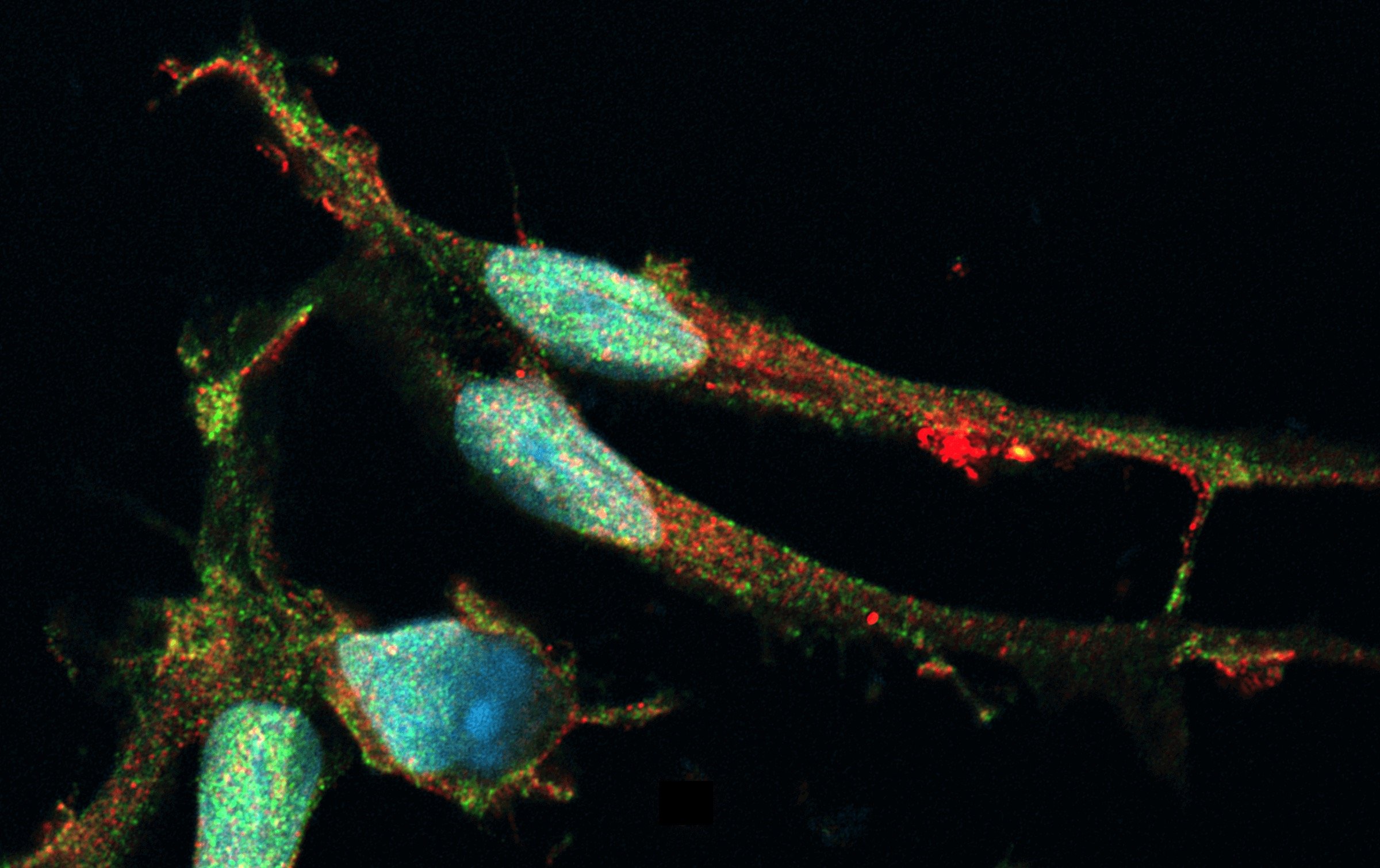 ioMicroglia™ and related disease models