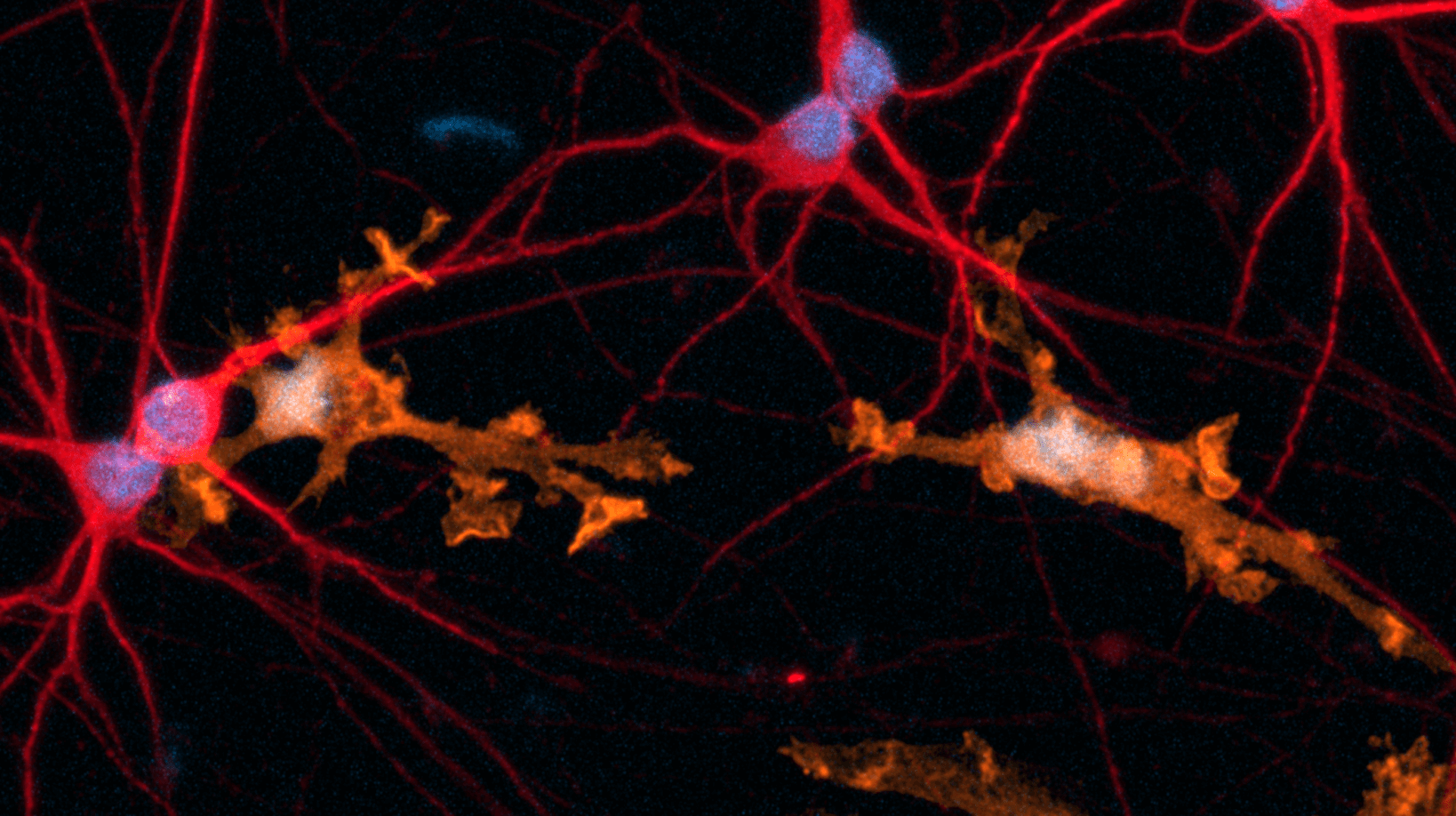 co culture low density progenitors re-size (1)