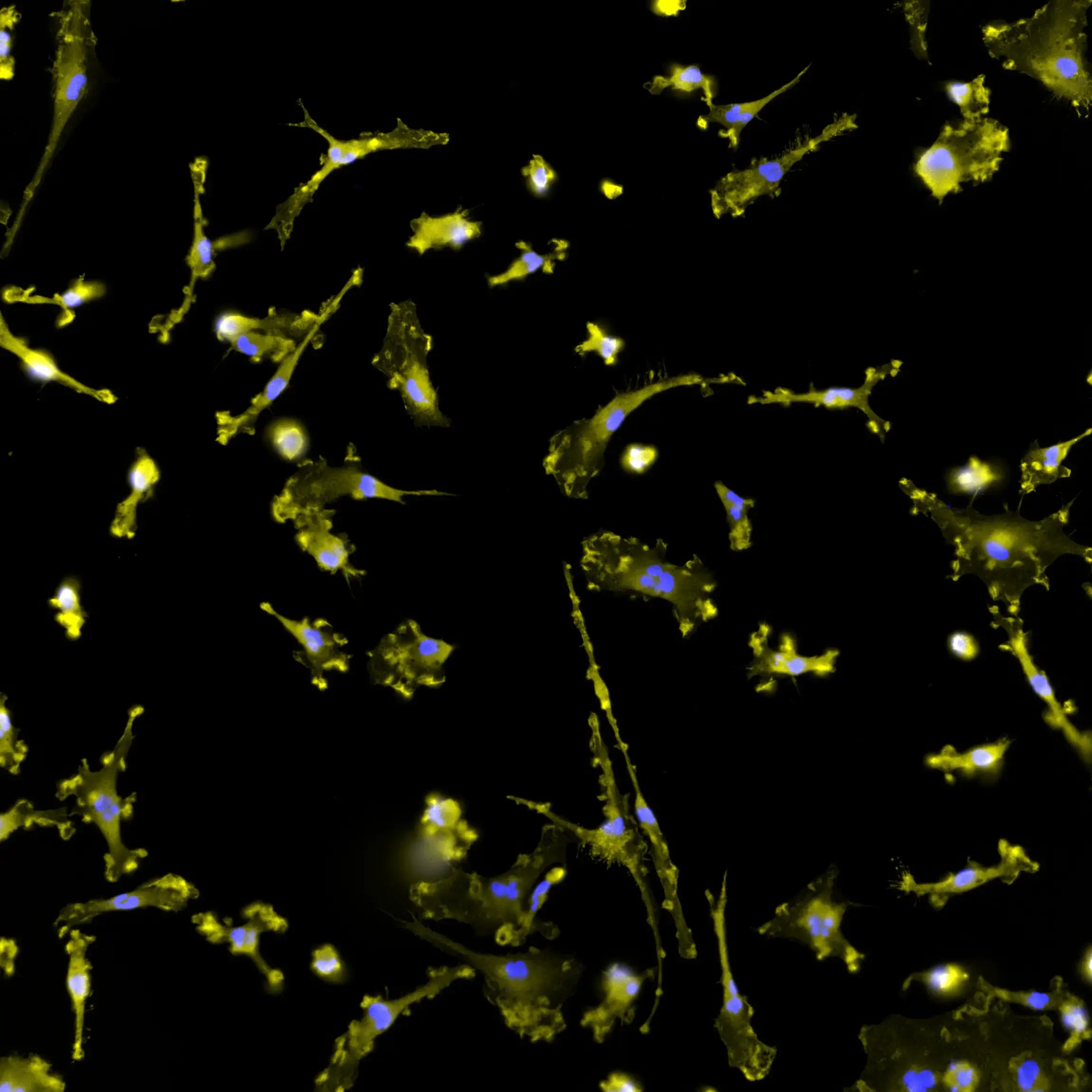 ioMicroglia GPNMB null/null